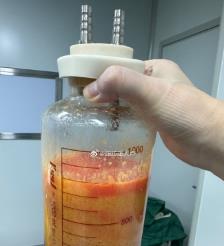 桓台水动力吸脂手术要做多久？